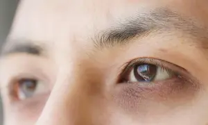 Gros plan sur un œil humain, montrant des cernes prononcés et des ridules, signes évidents de fatigue oculaire après une longue journée.