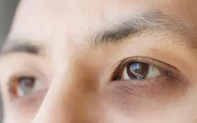 Gros plan sur un œil humain, montrant des cernes prononcés et des ridules, signes évidents de fatigue oculaire après une longue journée.